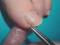 事前に作製したワイヤー