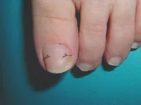 ワイヤーのフックの部分を爪に引っかけます